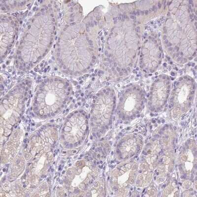 Immunohistochemistry-Paraffin: PNLDC1 Antibody [NBP2-13781]