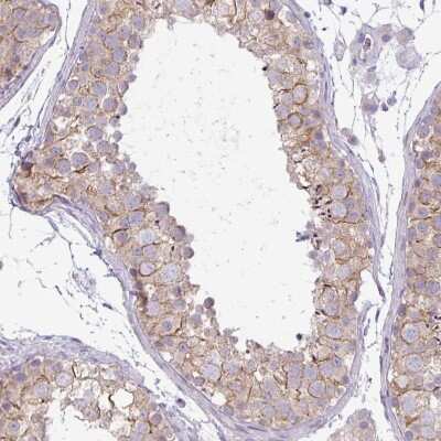 Immunohistochemistry-Paraffin: PNLDC1 Antibody [NBP2-13781]