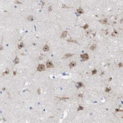 Immunohistochemistry-Paraffin: PNMA1 Antibody [NBP1-82808]