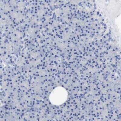 Immunohistochemistry-Paraffin: PNMA1 Antibody [NBP1-82808]