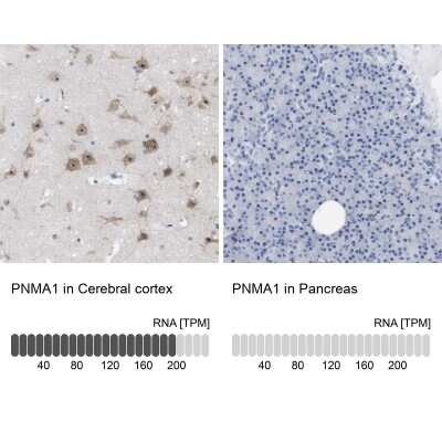 Immunohistochemistry-Paraffin: PNMA1 Antibody [NBP1-82808]