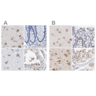 Immunohistochemistry-Paraffin: PNMA1 Antibody [NBP1-82808]