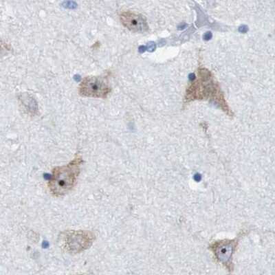 Immunohistochemistry-Paraffin: PNMA1 Antibody [NBP1-82808]