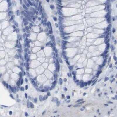 Immunohistochemistry-Paraffin: PNMA1 Antibody [NBP1-82808]