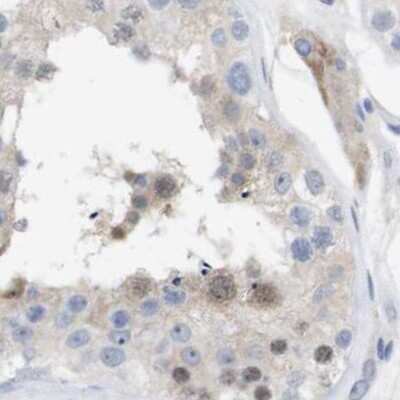 Immunohistochemistry-Paraffin: PNMA1 Antibody [NBP1-82808]
