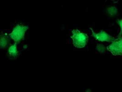 Immunocytochemistry/ Immunofluorescence: PNMT Antibody (OTI1D2) [NBP2-00688]