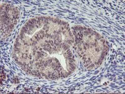 Immunohistochemistry-Paraffin: PNMT Antibody (OTI1D2) [NBP2-00688]