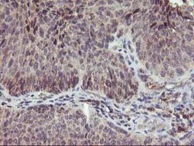 Immunohistochemistry-Paraffin: PNMT Antibody (OTI1D2) [NBP2-00688]