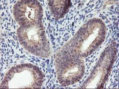 Immunohistochemistry-Paraffin: PNMT Antibody (OTI1D2) [NBP2-00688]