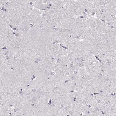 Immunohistochemistry-Paraffin: PNMT Antibody [NBP2-33392]