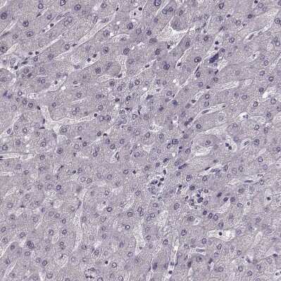 Immunohistochemistry-Paraffin: PNMT Antibody [NBP2-33602]