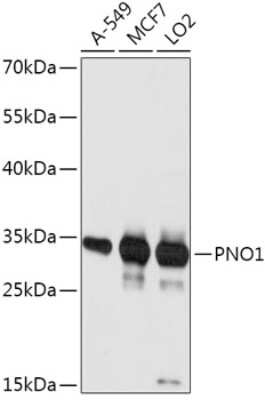 Western Blot: PNO1 AntibodyAzide and BSA Free [NBP2-94387]