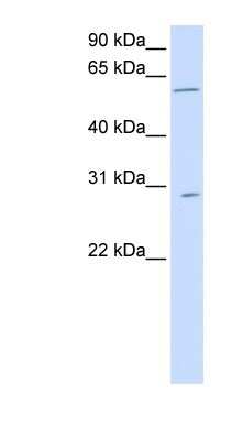 Western Blot: PNPLA4 Antibody [NBP1-57925]