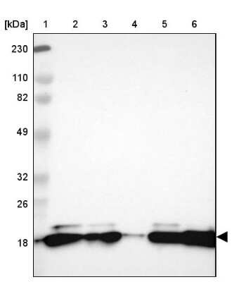 Western Blot: PNPLA4 Antibody [NBP1-84958]