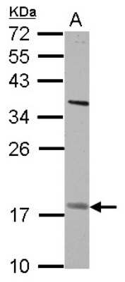 Western Blot: PNPLA4 Antibody [NBP2-19878]