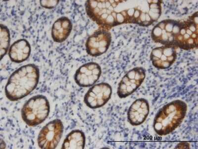 Immunohistochemistry-Paraffin: PNPLA6 Antibody (3D10) [H00010908-M08]