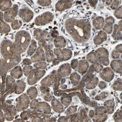 Immunohistochemistry-Paraffin: PNPLA7 Antibody [NBP1-91231]