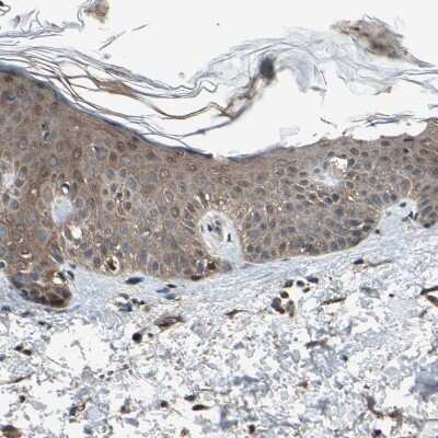 Immunohistochemistry-Paraffin: PNPLA7 Antibody [NBP1-91231]