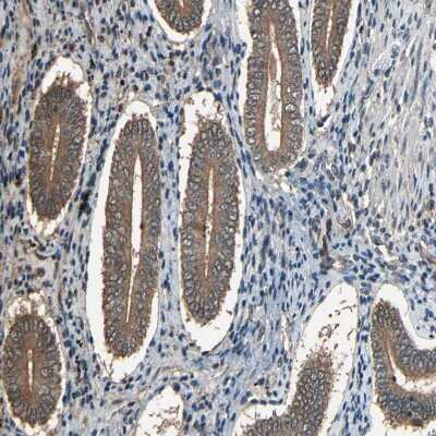 Immunohistochemistry-Paraffin: PNPLA7 Antibody [NBP1-91231]