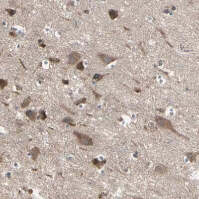 Immunohistochemistry-Paraffin: PNPLA7 Antibody [NBP1-91231]