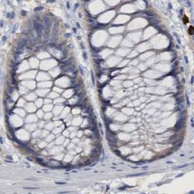 Immunohistochemistry-Paraffin: PNPO Antibody [NBP1-87303]