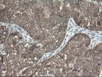 Immunohistochemistry: PNPO Antibody (OTI1G9) [NBP2-45361]