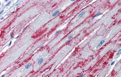 Immunohistochemistry-Paraffin: PNPT1 Antibody [NBP1-57179]