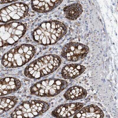 Immunohistochemistry-Paraffin: PNPT1 Antibody [NBP2-38211]