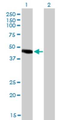 Western Blot: PNR/NR2E3 Antibody (2A12) [H00010002-M01]