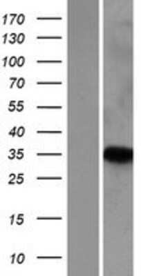 Western Blot: PNRC1 Overexpression Lysate [NBP2-07576]