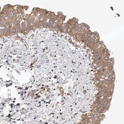 Immunohistochemistry-Paraffin: PNRC2 Antibody [NBP1-86384]