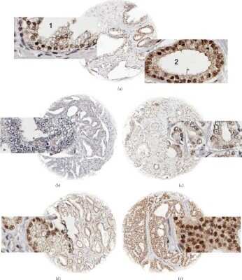 Immunohistochemistry: PNUTS/PPP1R10 Antibody [NB100-604]