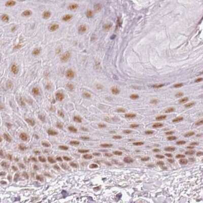 Immunohistochemistry-Paraffin: PNUTS/PPP1R10 Antibody [NBP2-38565]