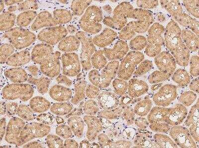 Immunohistochemistry-Paraffin: PODNL1 Antibody [NBP3-05990]