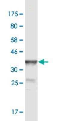 Western Blot: POGK Antibody (2D3) [H00057645-M02]