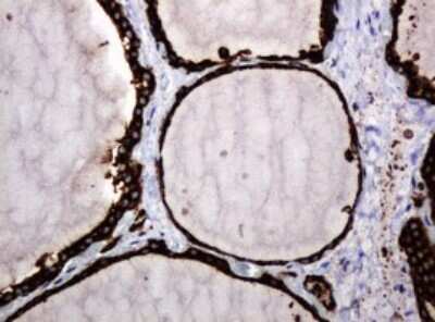 Immunohistochemistry: POGK Antibody (OTI6D5) [NBP2-45364]
