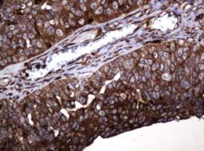 Immunohistochemistry: POGK Antibody (OTI6D5) [NBP2-45364]