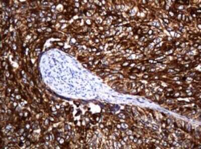 Immunohistochemistry: POGK Antibody (OTI6D5) [NBP2-45364]