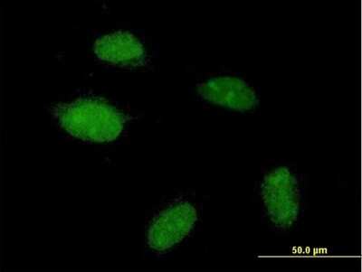Immunocytochemistry/ Immunofluorescence: POGZ Antibody [H00023126-B01P]