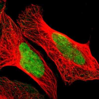 Immunocytochemistry/ Immunofluorescence: POGZ Antibody [NBP1-83004]