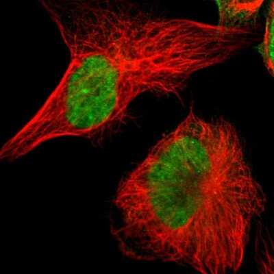 Immunocytochemistry/ Immunofluorescence: POGZ Antibody [NBP1-83005]