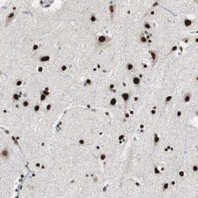 Immunohistochemistry-Paraffin: POGZ Antibody [NBP1-83005]