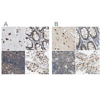 Immunohistochemistry-Paraffin: POGZ Antibody [NBP1-83005]