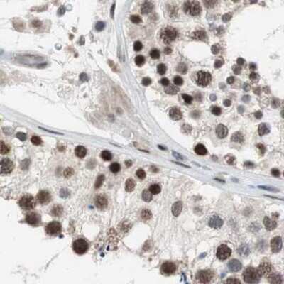 Immunohistochemistry-Paraffin: POGZ Antibody [NBP1-83005]