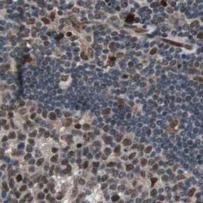 Immunohistochemistry-Paraffin: POGZ Antibody [NBP1-83005]