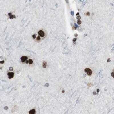 Immunohistochemistry-Paraffin: POGZ Antibody [NBP1-83005]