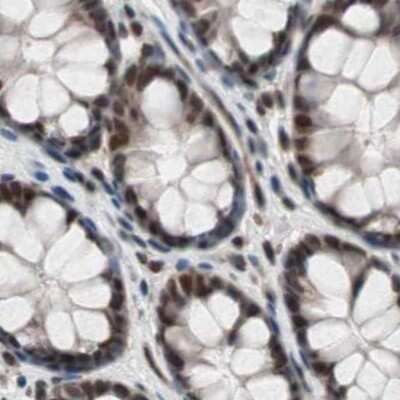 Immunohistochemistry-Paraffin: POGZ Antibody [NBP1-83005]