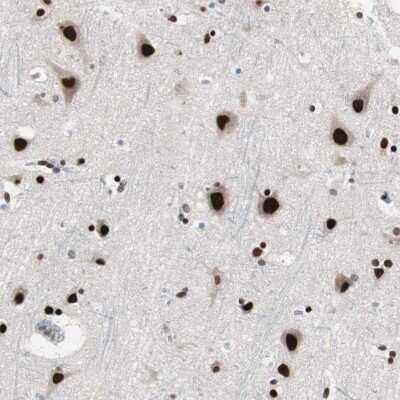 Immunohistochemistry-Paraffin: POGZ Antibody [NBP1-83005]