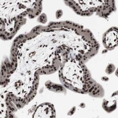 Immunohistochemistry-Paraffin: POGZ Antibody [NBP1-83005]