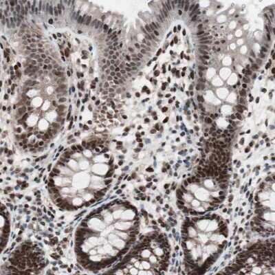 Immunohistochemistry-Paraffin: POGZ Antibody [NBP1-83005]